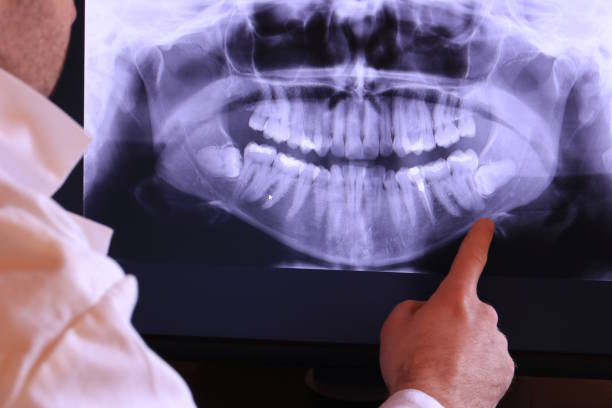 Best Holiday Emergency Dentist in O, MI